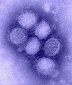 h1n1-schweinegrippe