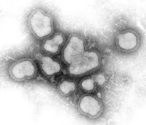 schweinegrippe-virus